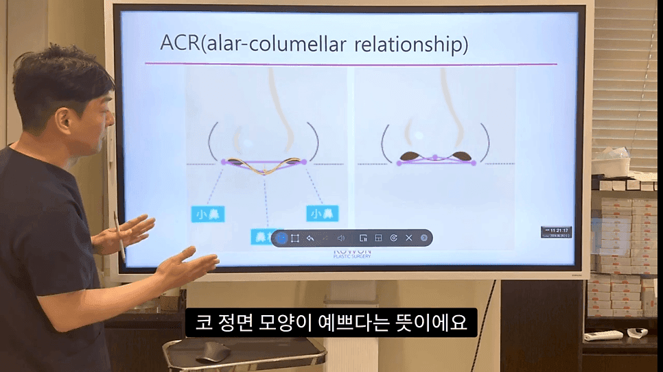 자연스러운 코끝은 왜 사각형일까 — ACR·비순각 90도와 돌출입 완화 효과 관련 이미지 8/35