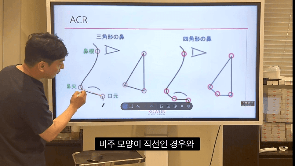 자연스러운 코끝은 왜 사각형일까 — ACR·비순각 90도와 돌출입 완화 효과 관련 이미지 10/35