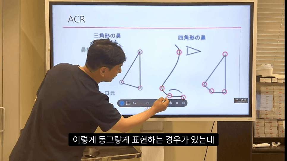 자연스러운 코끝은 왜 사각형일까 — ACR·비순각 90도와 돌출입 완화 효과 관련 이미지 11/35
