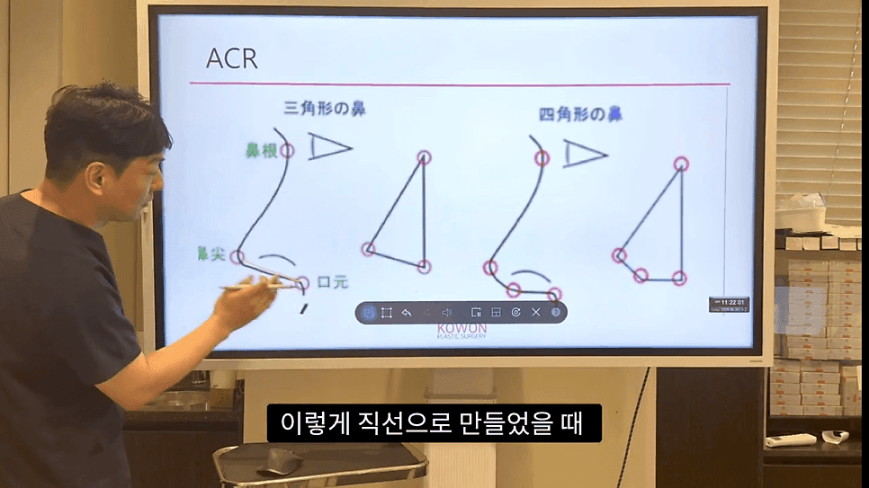 자연스러운 코끝은 왜 사각형일까 — ACR·비순각 90도와 돌출입 완화 효과 관련 이미지 12/35