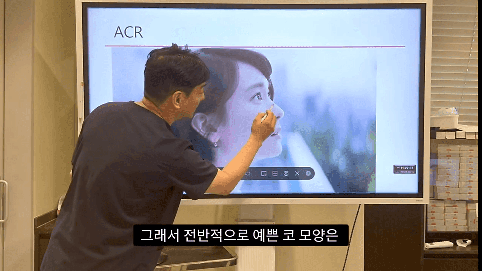 자연스러운 코끝은 왜 사각형일까 — ACR·비순각 90도와 돌출입 완화 효과 관련 이미지 13/35