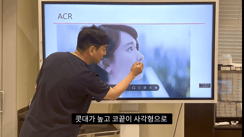 자연스러운 코끝은 왜 사각형일까 — ACR·비순각 90도와 돌출입 완화 효과 관련 이미지 14/35