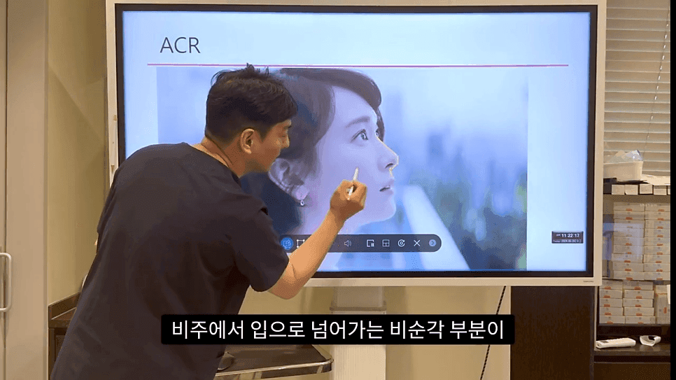 자연스러운 코끝은 왜 사각형일까 — ACR·비순각 90도와 돌출입 완화 효과 관련 이미지 15/35