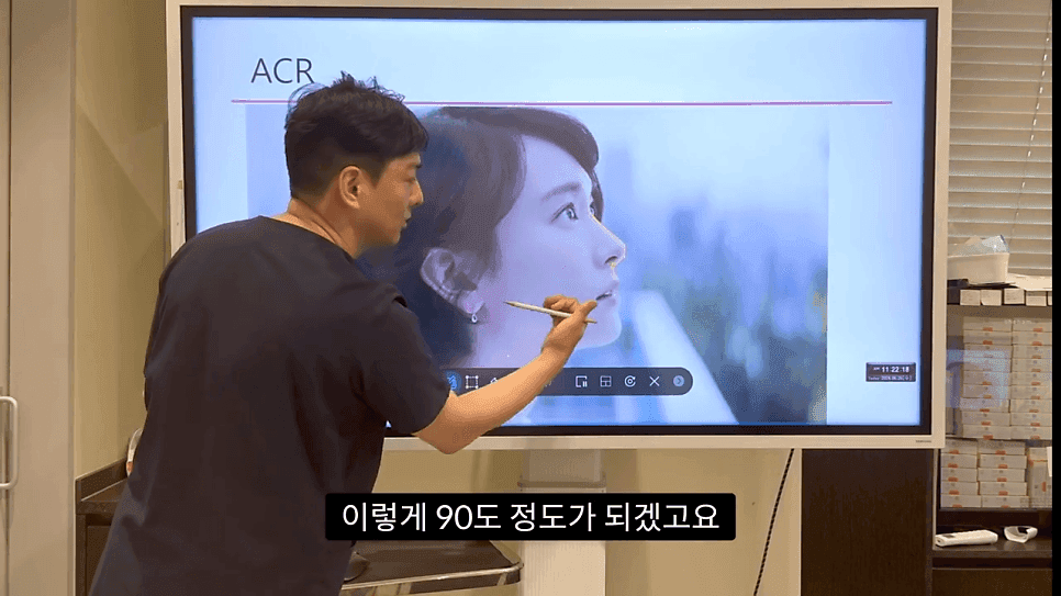 자연스러운 코끝은 왜 사각형일까 — ACR·비순각 90도와 돌출입 완화 효과 관련 이미지 16/35
