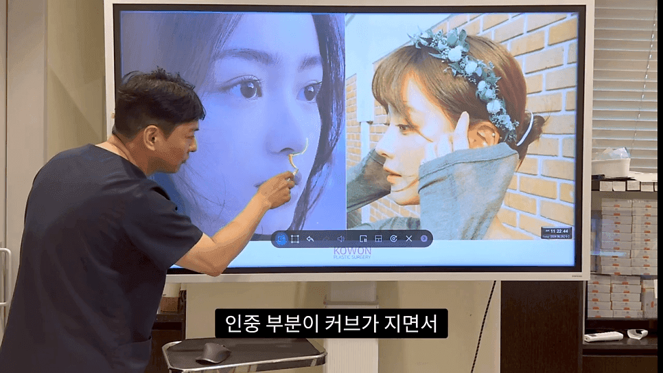 자연스러운 코끝은 왜 사각형일까 — ACR·비순각 90도와 돌출입 완화 효과 관련 이미지 17/35