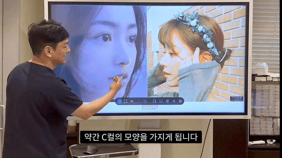 자연스러운 코끝은 왜 사각형일까 — ACR·비순각 90도와 돌출입 완화 효과 관련 이미지 18/35