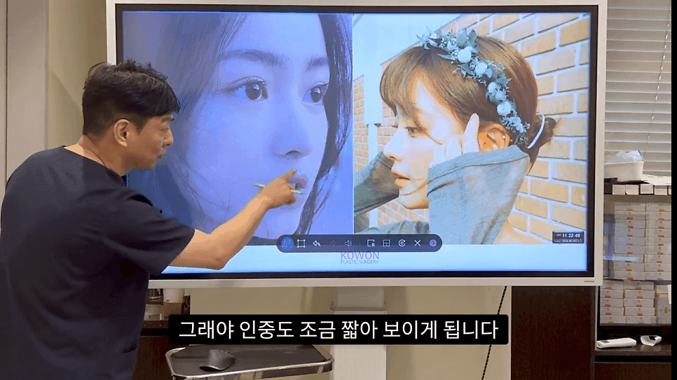 자연스러운 코끝은 왜 사각형일까 — ACR·비순각 90도와 돌출입 완화 효과 관련 이미지 19/35