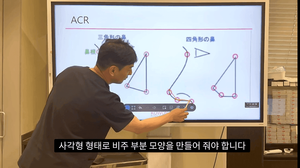 자연스러운 코끝은 왜 사각형일까 — ACR·비순각 90도와 돌출입 완화 효과 관련 이미지 20/35
