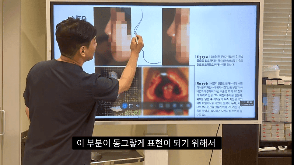 자연스러운 코끝은 왜 사각형일까 — ACR·비순각 90도와 돌출입 완화 효과 관련 이미지 21/35