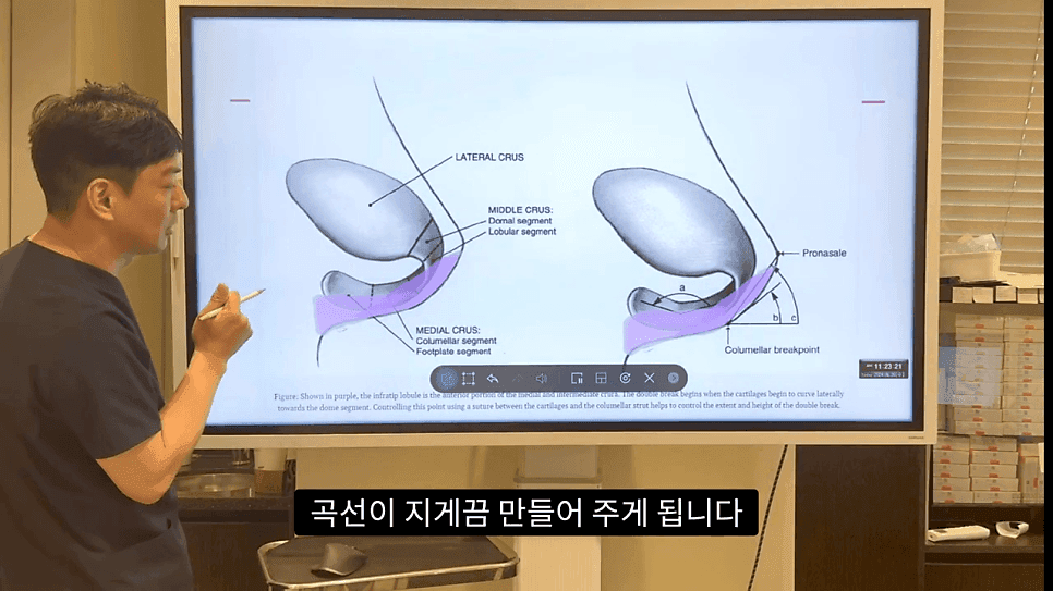 자연스러운 코끝은 왜 사각형일까 — ACR·비순각 90도와 돌출입 완화 효과 관련 이미지 25/35