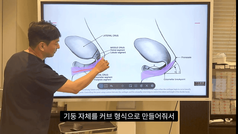 자연스러운 코끝은 왜 사각형일까 — ACR·비순각 90도와 돌출입 완화 효과 관련 이미지 28/35