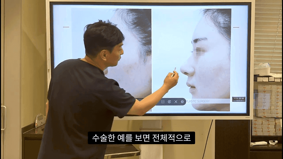 자연스러운 코끝은 왜 사각형일까 — ACR·비순각 90도와 돌출입 완화 효과 관련 이미지 31/35