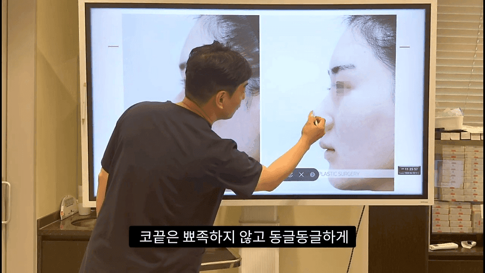 자연스러운 코끝은 왜 사각형일까 — ACR·비순각 90도와 돌출입 완화 효과 관련 이미지 32/35