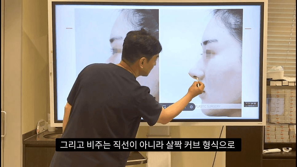 자연스러운 코끝은 왜 사각형일까 — ACR·비순각 90도와 돌출입 완화 효과 관련 이미지 33/35