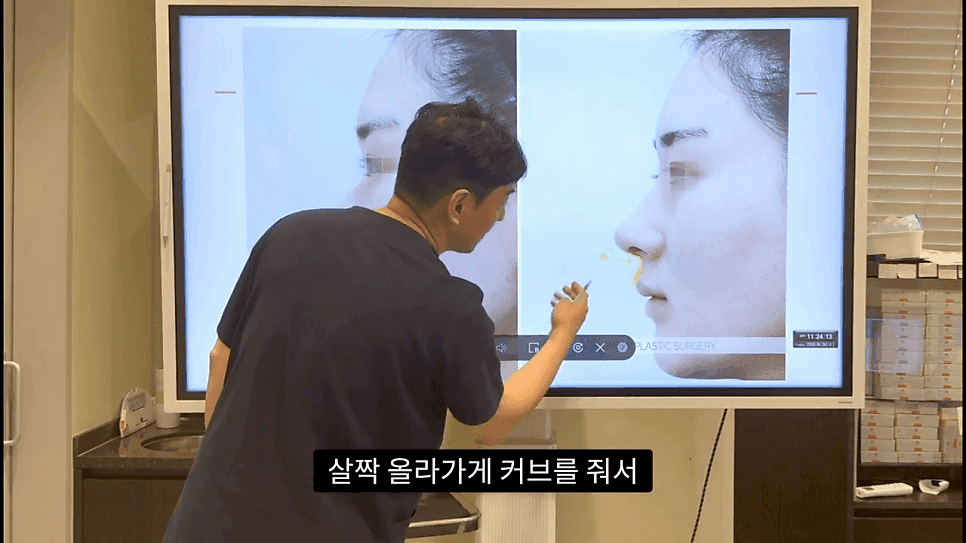 자연스러운 코끝은 왜 사각형일까 — ACR·비순각 90도와 돌출입 완화 효과 관련 이미지 35/35