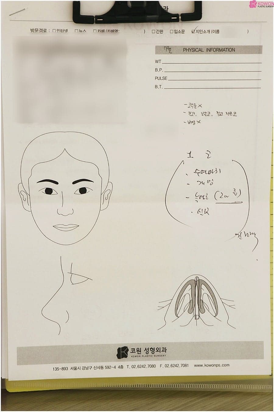 콧볼성형, 실패를 줄이려면 — 외측·내측 절개의 차이와 전체 구조를 함께 보는 이유 관련 이미지 8/8