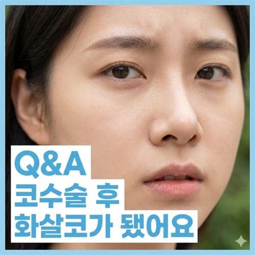 코수술 후 화살코가 됐다면 — 들린 코 교정 뒤 비주가 내려온 경우의 재수술 Q&A 관련 이미지 1/8