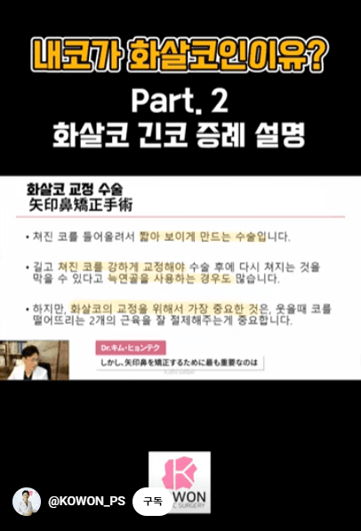 화살코 교정과 긴코성형 — 수술 후에도 코가 다시 처지지 않으려면 근육까지 봐야 하는 이유 관련 이미지 2/15