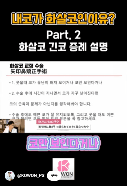 화살코 교정과 긴코성형 — 수술 후에도 코가 다시 처지지 않으려면 근육까지 봐야 하는 이유 관련 이미지 4/15