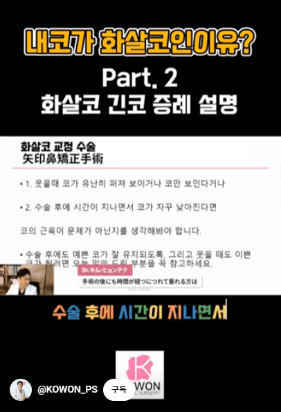 화살코 교정과 긴코성형 — 수술 후에도 코가 다시 처지지 않으려면 근육까지 봐야 하는 이유 관련 이미지 5/15