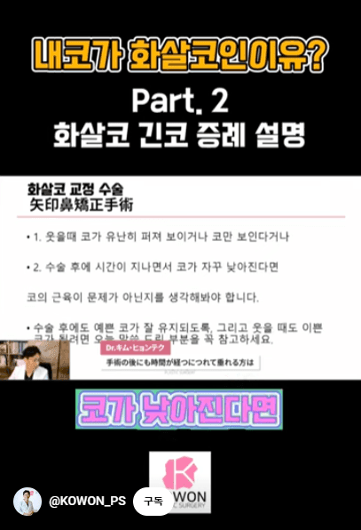 화살코 교정과 긴코성형 — 수술 후에도 코가 다시 처지지 않으려면 근육까지 봐야 하는 이유 관련 이미지 6/15