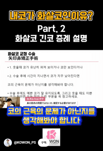 화살코 교정과 긴코성형 — 수술 후에도 코가 다시 처지지 않으려면 근육까지 봐야 하는 이유 관련 이미지 7/15