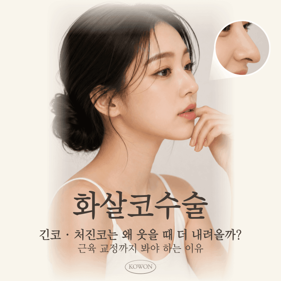 화살코수술, 웃을 때 코끝이 더 내려오는 이유 — 지지력·근육·비순각 확인 순서 관련 이미지 1/2