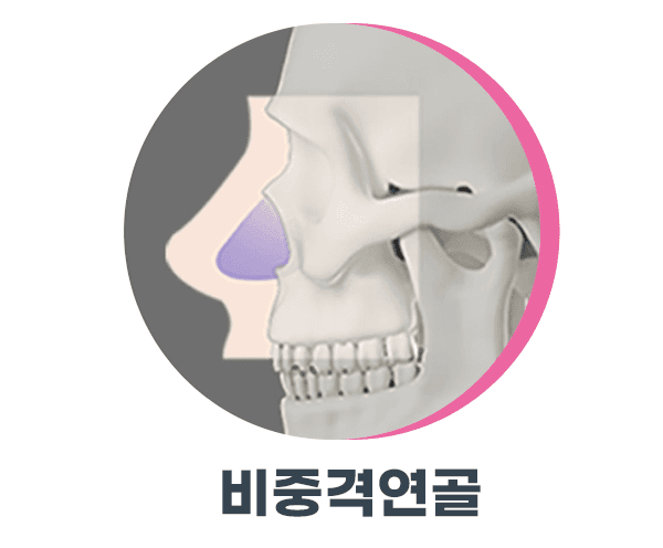 การผ่าตัดจมูกด้วยกระดูกอ่อนของตนเอง เหตุใดจึงควรเริ่มต้นด้วยโครงสร้าง — กระดูกอ่อนสามประเภทและเกณฑ์ในการเลือกโรงพยาบาล ภาพที่เกี่ยวข้อง 4/6