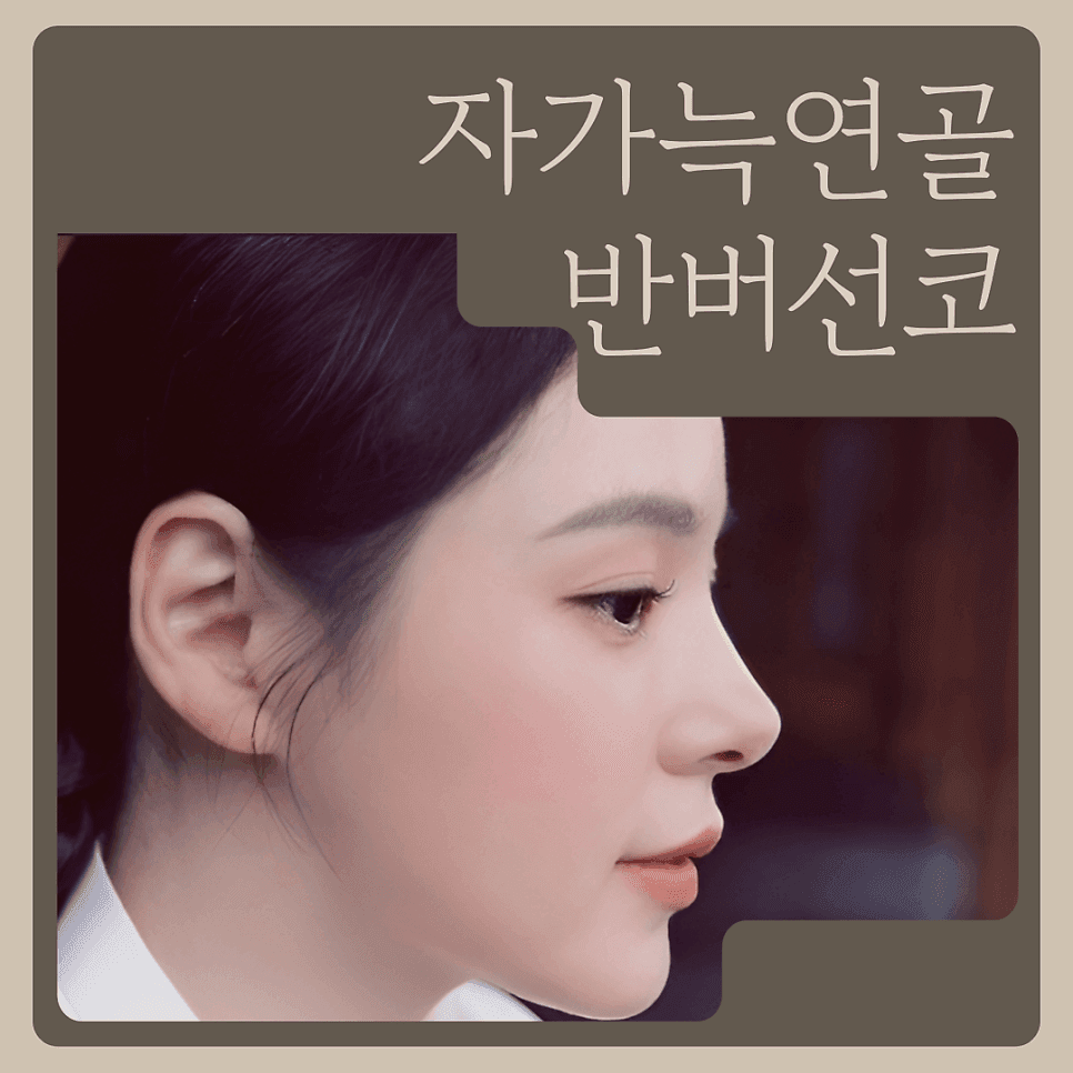 반버선코, 누구에게나 어울릴까 — 얼굴 구조 확인과 자가늑연골 RIBFIT™ 리브핏을 고려하는 이유 관련 이미지 1/6