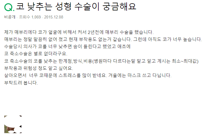 매부리코 교정 후에도 코가 크다면 — 큰코 축소수술의 방식과 한계 관련 이미지 2/2