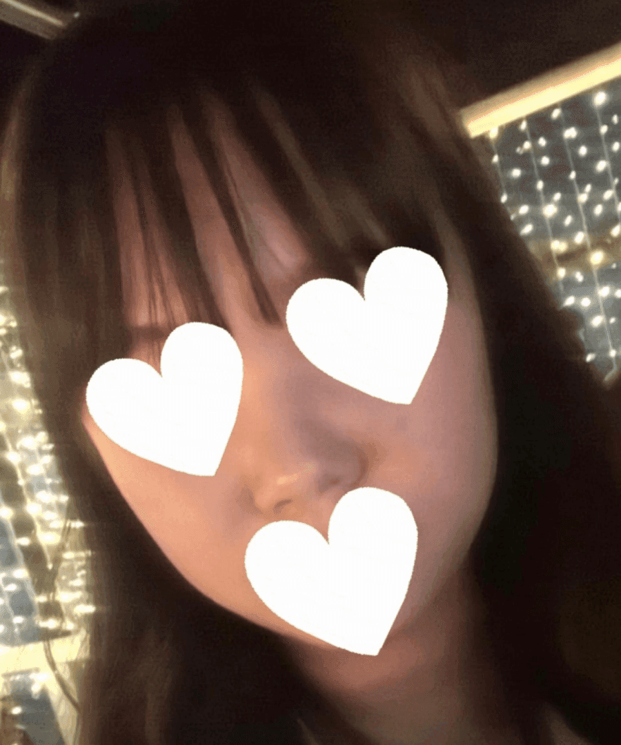 작고 뭉뚝한 코, 비중격만곡증까지 있다면 — 기능코수술을 함께 계획한 사례 관련 이미지 3/17