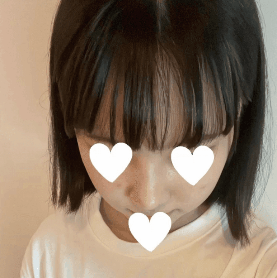 작고 뭉뚝한 코, 비중격만곡증까지 있다면 — 기능코수술을 함께 계획한 사례 관련 이미지 8/17