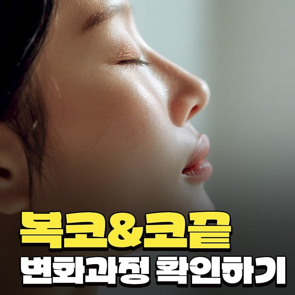 복코수술 전후 변화 — 코끝 구조 정리 과정과 "얼마나 작아질 수 있나"의 현실적 기준 관련 이미지 1/10