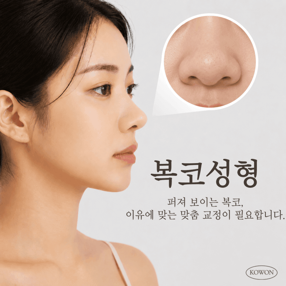 복코성형, 콧볼만 줄이면 될까요? — 뭉툭한코·퍼진코·웃을 때 퍼진 코 구분 관련 이미지 1/2