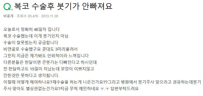 복코수술 46일 차, 붓기 때문에 인위적으로 보이면 재수술을 생각해야 하나요? 관련 이미지 2/8