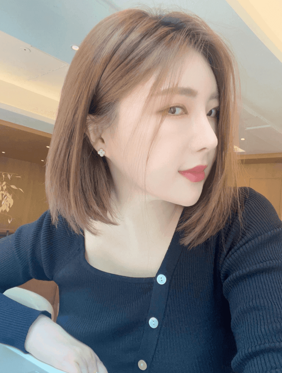 수술 후 짧아진 코, 자가늑 코재수술 사례 — 구축은 왜 생기고 어디까지 교정했나 관련 이미지 2/20