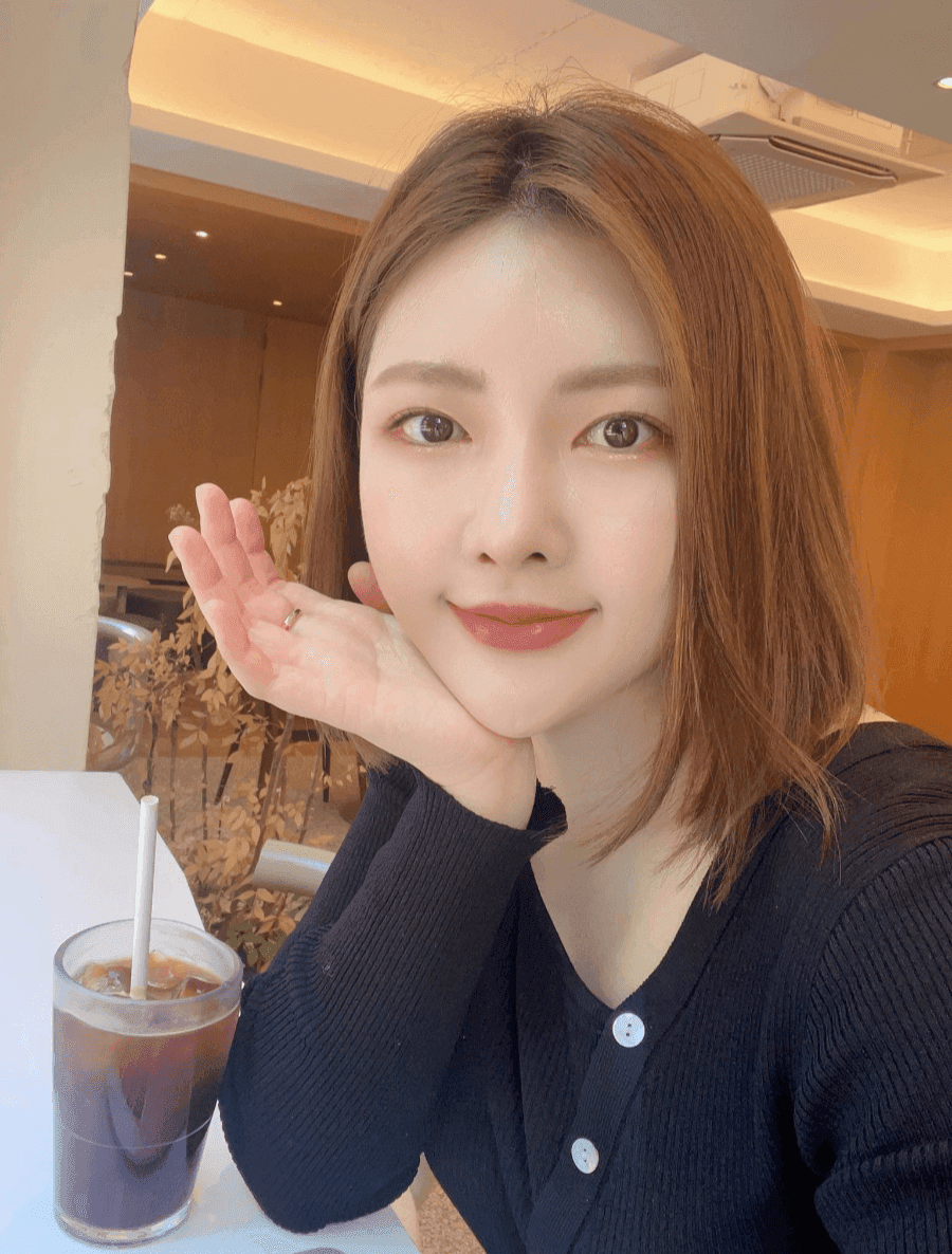 수술 후 짧아진 코, 자가늑 코재수술 사례 — 구축은 왜 생기고 어디까지 교정했나 관련 이미지 13/20