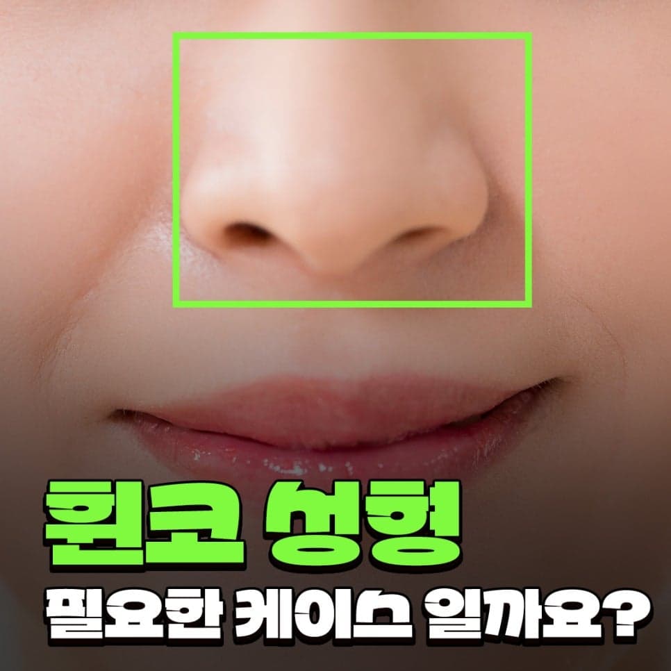 휜코성형과 양악수술, 어느 쪽을 먼저 해야 할까 — 순서와 원인부터 확인하는 이유 관련 이미지 1/9