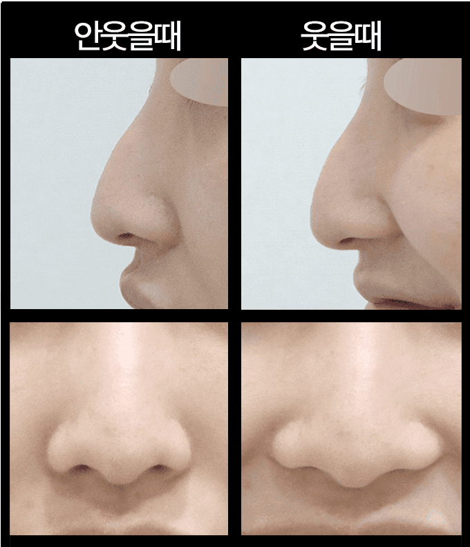 ผู้อำนวย KOWON Plastic Surgery Kim Hyung-taek (คิม ฮยองแท็ก) — เหตุใดการรักษาจึงเริ่มต้นด้วยการ 'รับฟัง' ภาพประกอบ 11/14