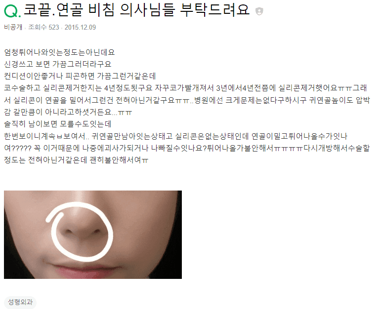 실리콘 제거 후 코끝에 귀연골이 비쳐 보인다면 — 튀어나오거나 괴사할까 걱정될 때 관련 이미지 2/2