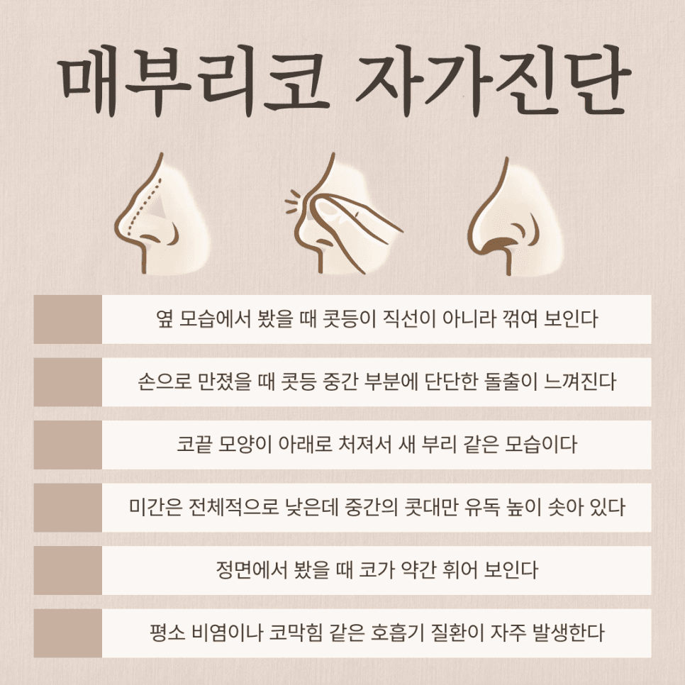 여자 매부리코, 무보형물 코수술로도 교정할 수 있나요? — 원인·자가진단·재료 선택 관련 이미지 3/8