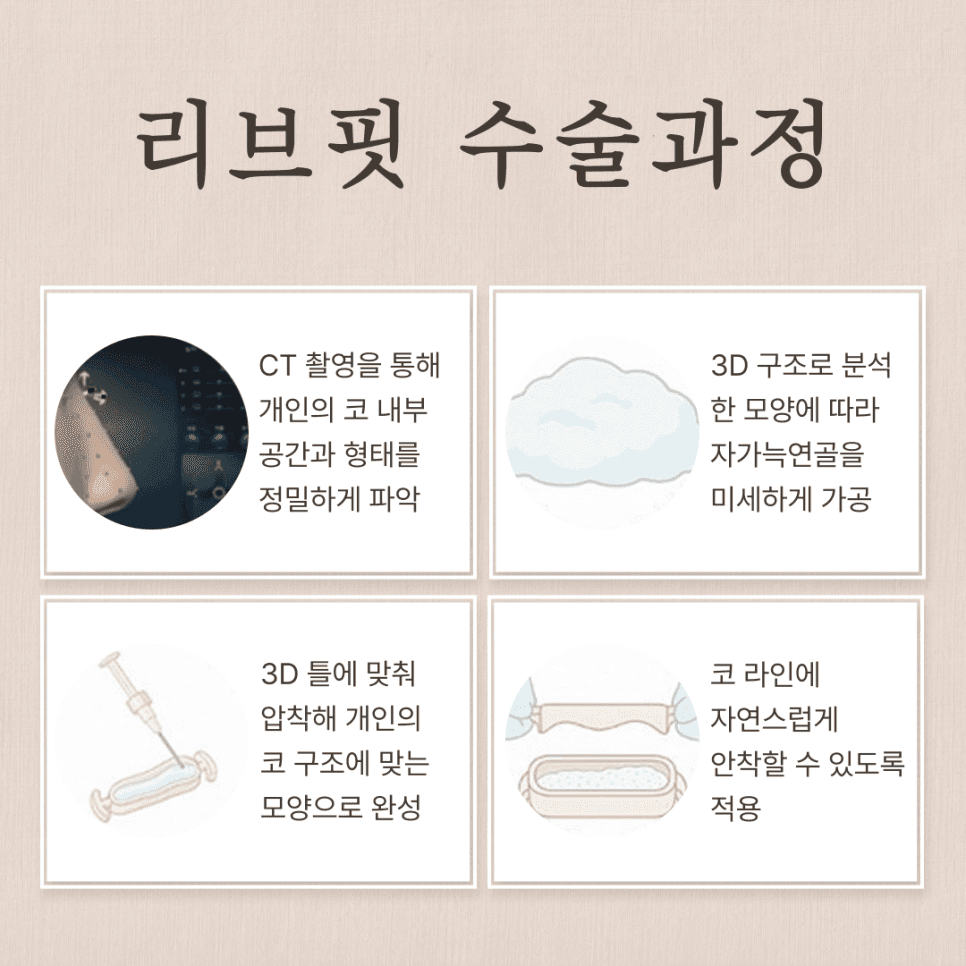 여자 매부리코, 무보형물 코수술로도 교정할 수 있나요? — 원인·자가진단·재료 선택 관련 이미지 6/8