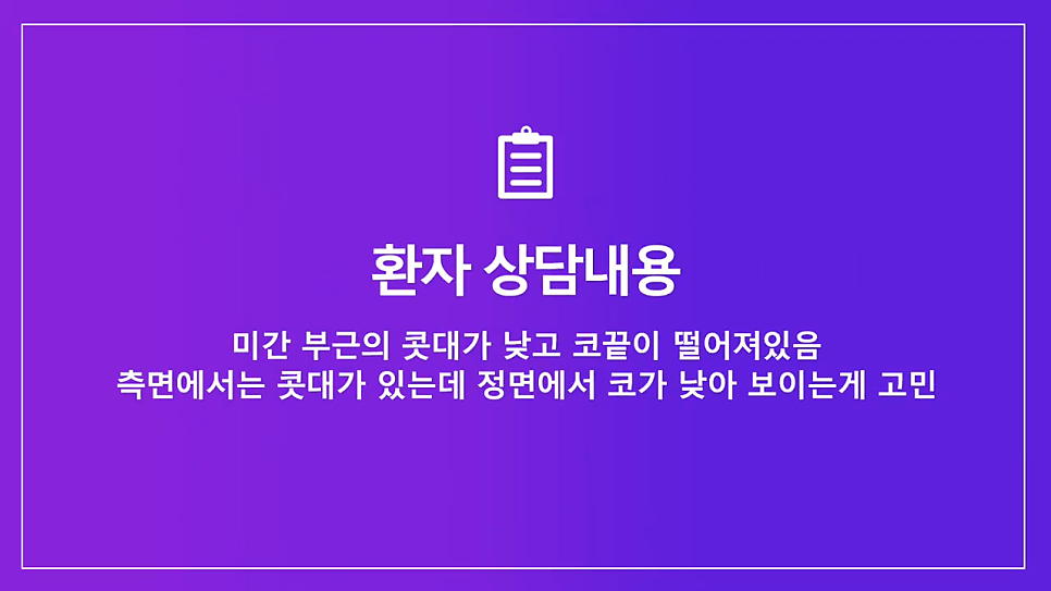 여자 낮은코 교정 사례 — 정면에서만 낮아 보이는 코, 비중격 연장과 절골술로 확인한 것 관련 이미지 2/8