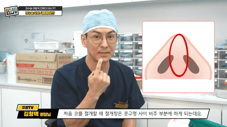 첫코성형과 코재수술의 차이 — 절개·봉합에서 흉터를 줄이는 방법 관련 이미지 2/20