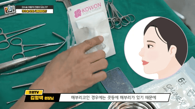 첫코성형과 코재수술의 차이 — 절개·봉합에서 흉터를 줄이는 방법 관련 이미지 7/20