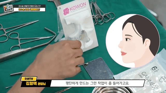첫코성형과 코재수술의 차이 — 절개·봉합에서 흉터를 줄이는 방법 관련 이미지 8/20