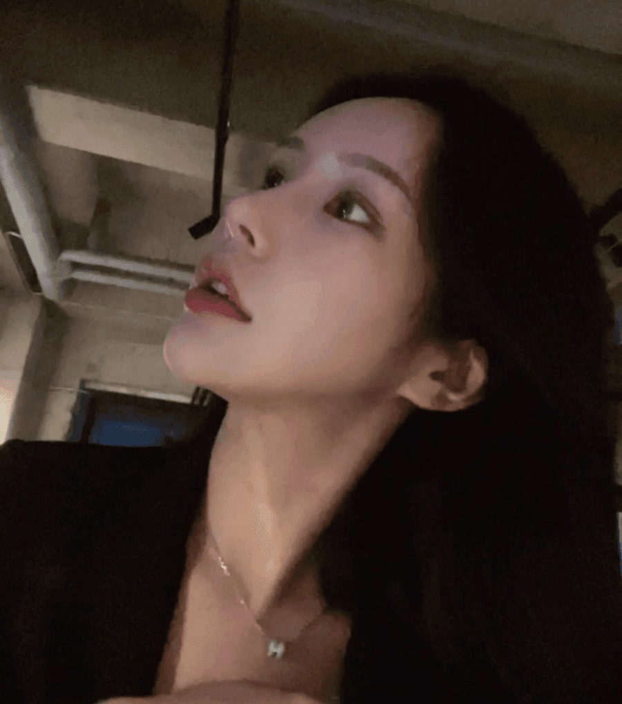 너무 높고 화려한 코, 자연스럽게 낮추는 재수술 — 귀연골·비중격 교정 관련 이미지 2/29