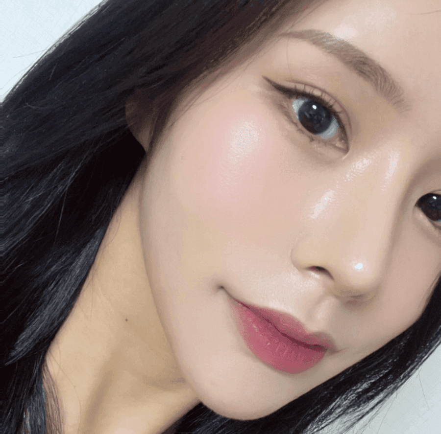 너무 높고 화려한 코, 자연스럽게 낮추는 재수술 — 귀연골·비중격 교정 관련 이미지 3/29