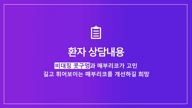 매부리코수술로 콧구멍 비대칭까지 본 사례 — 난도가 높아지는 이유와 확인 순서 관련 이미지 2/8