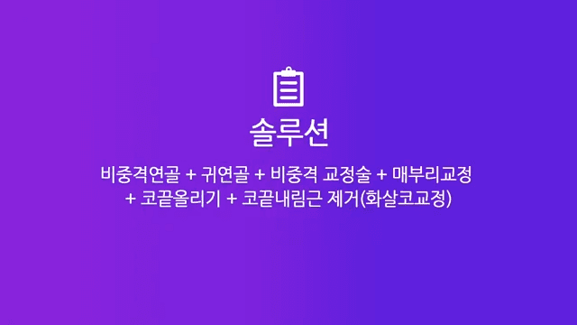 매부리코수술로 콧구멍 비대칭까지 본 사례 — 난도가 높아지는 이유와 확인 순서 관련 이미지 3/8